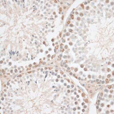 Immunohistochemistry-Paraffin: HMGN1/HMG14 Antibody [NBP3-03219] - Immunohistochemistry of paraffin-embedded mouse testis using HMGN1/HMG14 antibody (NBP3-03219) at dilution of 1:100 (40x lens). Perform microwave antigen retrieval with 10 mM PBS buffer pH 7.2 before commencing with IHC staining protocol.